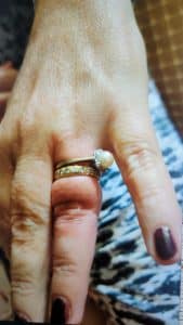 טבעת על אצבע צילום דוברות כבאות והצלה מחוז דן