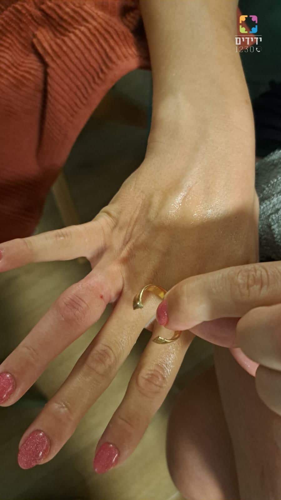 טבעת אצבעות חילוץ צילום ידידים סיוע בדרכים