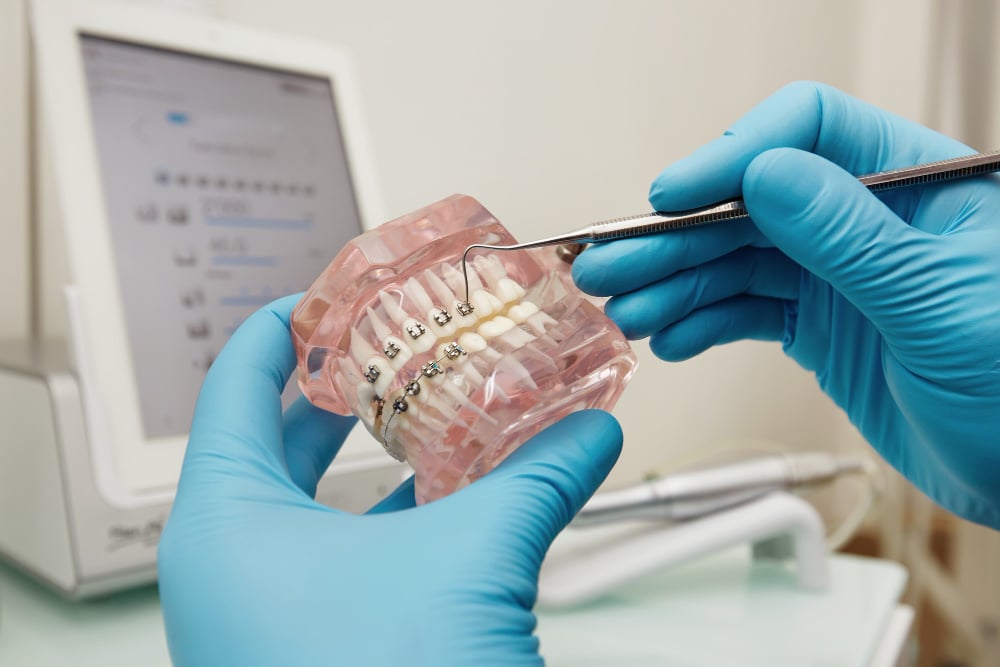 dentist-holding-dental-plastic-model-with-braces